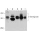 δ-sarcoglycan Antibody (B-5) - Western Blotting - Image 363247 