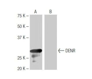 DENR Antibody (NQ-B8) - Western Blotting - Image 64909 