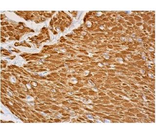 Desmin Antibody (10H7D2) - Immunohistochemistry - Image 357834 