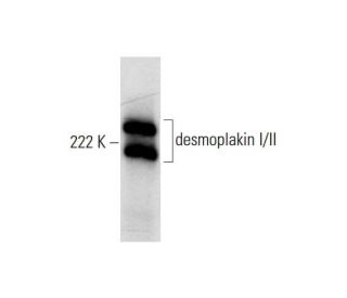 desmoplakin I/II Antibody (A-1) - Western Blotting - Image 291865Each CRISPR/Cas9 Knockout (KO) Plasmid product consists of a pool of 3 plasmids designed to ensure identification and cleavage of a specific gene for maximum knockout efficiency. Each plasmid encodes a unique 20 nt sequence derived from the GeCKO (v2) library.