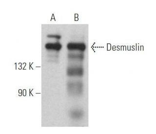 Desmuslin Antibody (B-8) - Western Blotting - Image 369433 