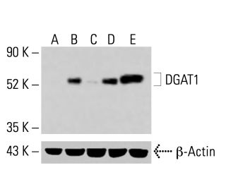 DGAT1 Antibody (A-5) - Western Blotting - Image 414160 