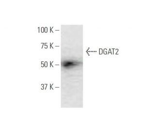 DGAT2 Antibody (4C1) - Western Blotting - Image 347631SAM Transcription Activation: SAM system utilizing dCas9-VP64, MS2-P65-HSF1, and sgRNA for precise gene transcription activation.