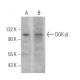 DGK-β Antibody (G-11) - Western Blotting - Image 370039