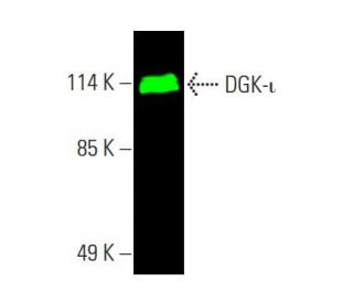 DGK-&iota; Antibody (G-3) - Western Blotting - Image 387297 
