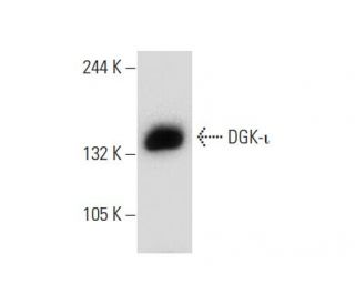 DGK-ι Antibody (D-4) - Western Blotting - Image 133965Each CRISPR/Cas9 Knockout (KO) Plasmid product consists of a pool of 3 plasmids designed to ensure identification and cleavage of a specific gene for maximum knockout efficiency. Each plasmid encodes a unique 20 nt sequence derived from the GeCKO (v2) library.