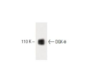 DGK-&theta; Antibody (24) - Western Blotting - Image 60281 