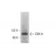 DGK-θ Antibody (E-5) - Western Blotting - Image 376350 
