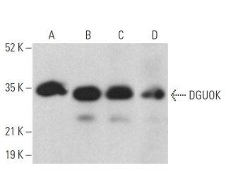 DGUOK Antibody (G-11) - Western Blotting - Image 369025 