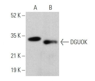 DGUOK Antibody (G-2) - Western Blotting - Image 369021 