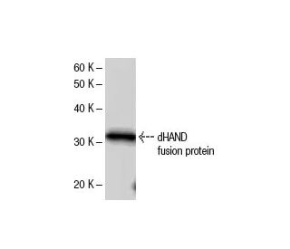 dHAND Antibody (HAND2C1a) - Western Blotting - Image 47852
