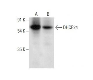 DHCR24 Antibody (A-4) - Western Blotting - Image 309555 