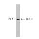 DHFR Antibody (49) - Western Blotting - Image 127511
