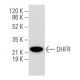 DHFR Antibody (C-4) - Western Blotting - Image 354885