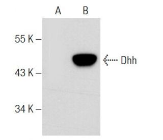 Dhh Antibody (F-8) - Western Blotting - Image 57608
