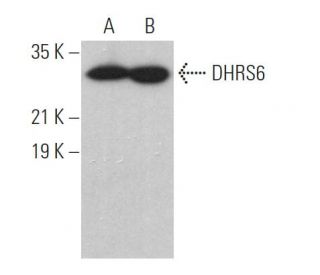 DHRS6 Antibody (H-5) - Western Blotting - Image 374396 