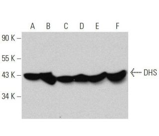 DHS Antibody (C-7) - Western Blotting - Image 359411 