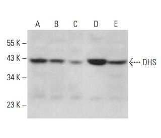 DHS Antibody (G-12) - Western Blotting - Image 379915 