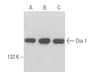 Dia 1 Antibody (E-4) - Western Blotting - Image 356093