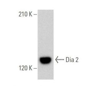 Dia 2 Antibody (B-11) - Western Blotting - Image 358896 