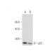 Dibutyryl-cAMP: sc-201567. Western blot analysis of p27 expression in untreated (A) and Dibutyryl-cAMP treated (B) SH-SY5Y