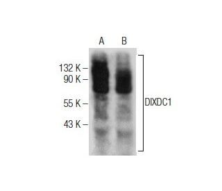 DIXDC1 Antibody (A-6) - Western Blotting - Image 281851