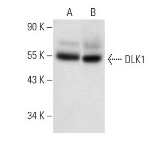 DLK1 Antibody (B-7) - Western Blotting - Image 301276 