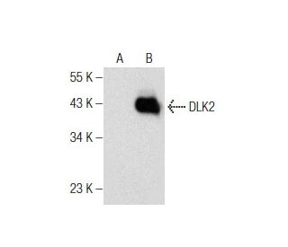 DLK2 Antibody (B-10) - Western Blotting - Image 160484