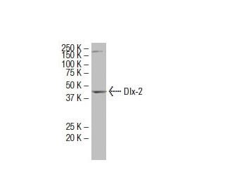 Dlx-2 Antibody (WQ6) - Western Blotting - Image 33610 