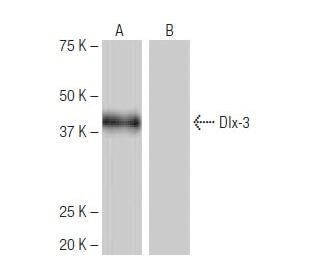 Dlx-3 Antibody (3-RE45) - Western Blotting - Image 64911