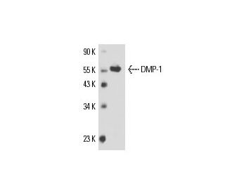 DMP-1 Antibody (LFMb-31) - Western Blotting - Image 17378 