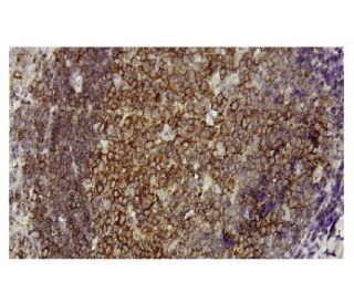 DnaJA4 Antibody (LL2) - Immunohistochemistry - Image 36128 