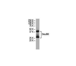DnaJB6 Antibody (RQ-6) - Western Blotting - Image 34082 