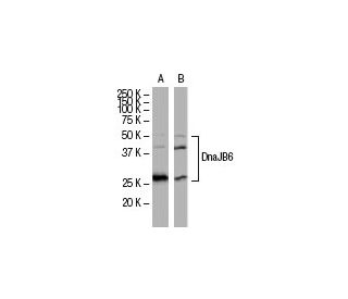 DnaJB6 Antibody (RQ-6) - Western Blotting - Image 34083