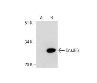 DnaJB6 Antibody (RQ-6) - Western Blotting - Image 282654 