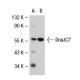 DnaJC7 Antibody (82SS) - Western Blotting - Image 31884