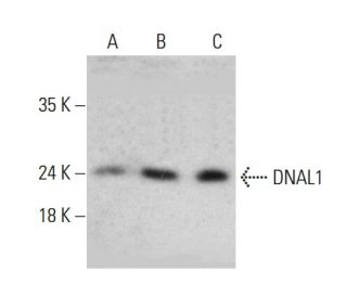 DNAL1 Antibody (AT29E4) - Western Blotting - Image 385147