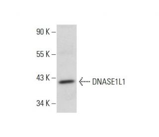 DNASE1L1 Antibody (KK-M3) - Western Blotting - Image 308271 