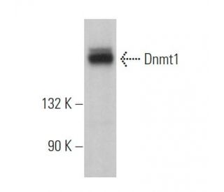 Dnmt1 Antibody (D-9) - Western Blotting - Image 360932The Double Nickase Plasmid features a U6 promoter for sgRNA expression, a 20 nt targeting sequence, and a gRNA scaffold to guide Cas9n. It includes a CBh promoter for Cas9n (D10A) and puromycin resistance, GFP for transfection verification, and nuclear localization signals (NLS). The 2A peptide allows co-expression of Cas9n and Puro from a single promoter, enabling precise genome editing with reduced off-target effects.