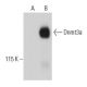 Dnmt3a Antibody (64B1446) - Western Blotting - Image 36390 