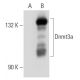 Dnmt3a Antibody (64B1446) - Western Blotting - Image 42613