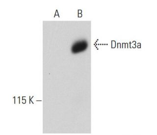 Dnmt3a Antibody (64B814) - Western Blotting - Image 36388