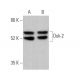 Dok-2 Antibody (G-3) - Western Blotting - Image 373083 