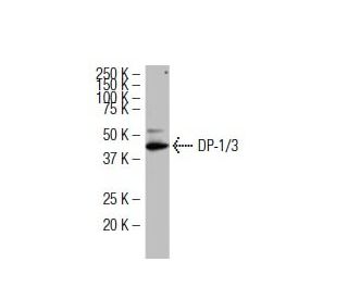 DP-1/3 Antibody (L7-7) - Western Blotting - Image 34396 