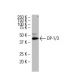 DP-1/3 Antibody (L7-7) - Western Blotting - Image 34396 