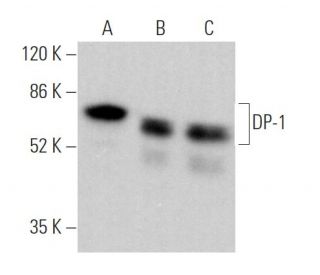 DP-1 Antibody (2Q471) - Western Blotting - Image 370113 