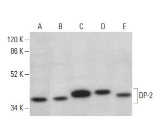 DP-2 Antibody (G-12) - Western Blotting - Image 376630 