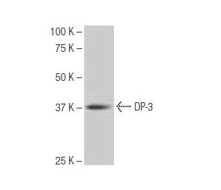 DP-3 Antibody (8G11) - Western Blotting - Image 64917