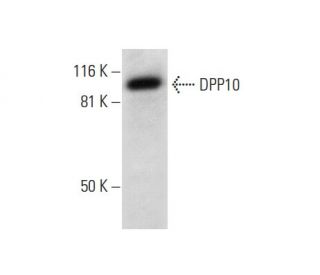 DPP10 Antibody (B-3) - Western Blotting - Image 301349