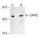 DPPA2 Antibody (H-10) - Western Blotting - Image 412208